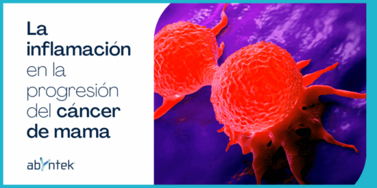 Inflamacion-Cancer-Mama